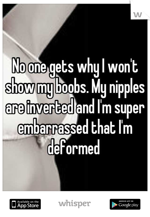 No one gets why I won't show my boobs. My nipples are inverted and I'm super embarrassed that I'm deformed 