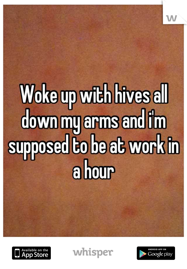 Woke up with hives all down my arms and i'm supposed to be at work in a hour
