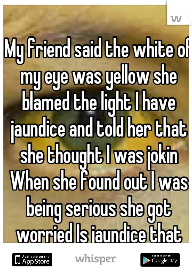 My friend said the white of my eye was yellow she blamed the light I have jaundice and told her that she thought I was jokin When she found out I was being serious she got worried Is jaundice that bad?