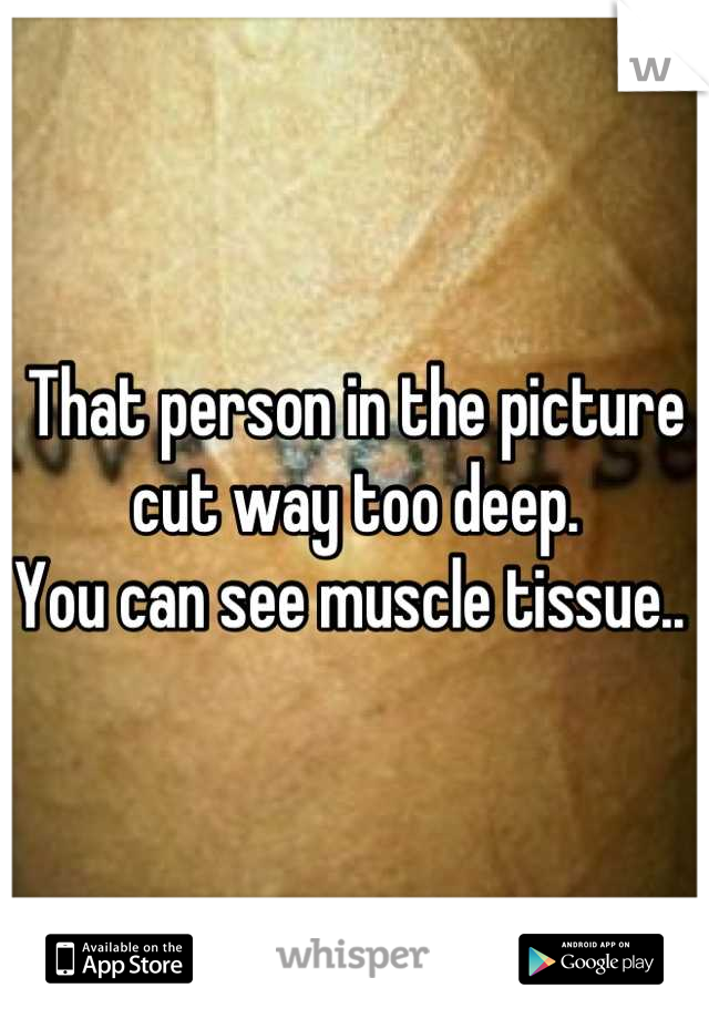 That person in the picture cut way too deep.
You can see muscle tissue.. 