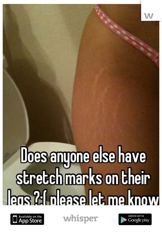 Does anyone else have stretch marks on their legs ?:( please let me know I'm not alone.. (Not my pic)