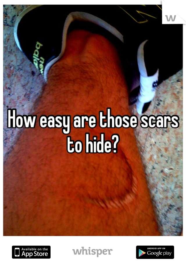 How easy are those scars to hide?
