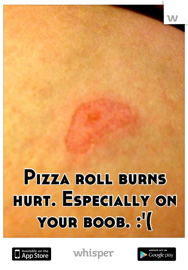 Pizza roll burns hurt. Especially on your boob. :'(