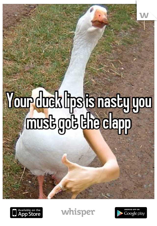 Your duck lips is nasty you must got the clapp