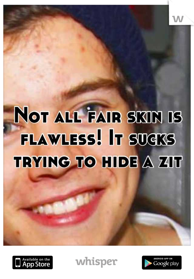 Not all fair skin is flawless! It sucks trying to hide a zit