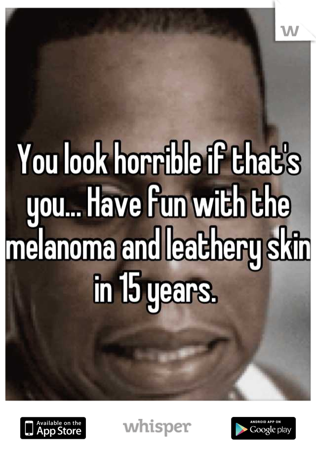 You look horrible if that's you... Have fun with the melanoma and leathery skin in 15 years. 