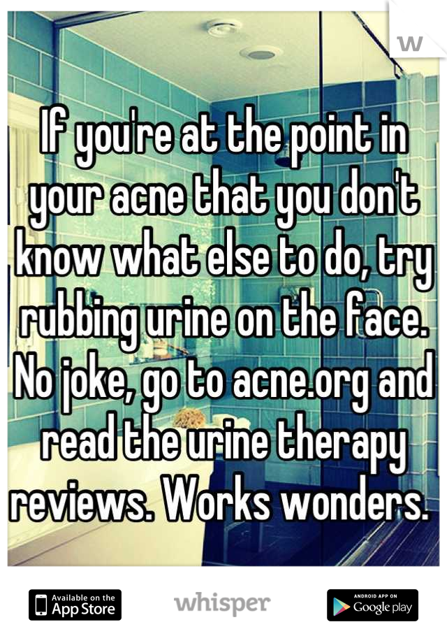 If you're at the point in your acne that you don't know what else to do, try rubbing urine on the face. No joke, go to acne.org and read the urine therapy reviews. Works wonders. 