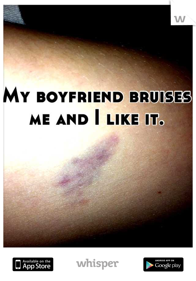 My boyfriend bruises me and I like it.
