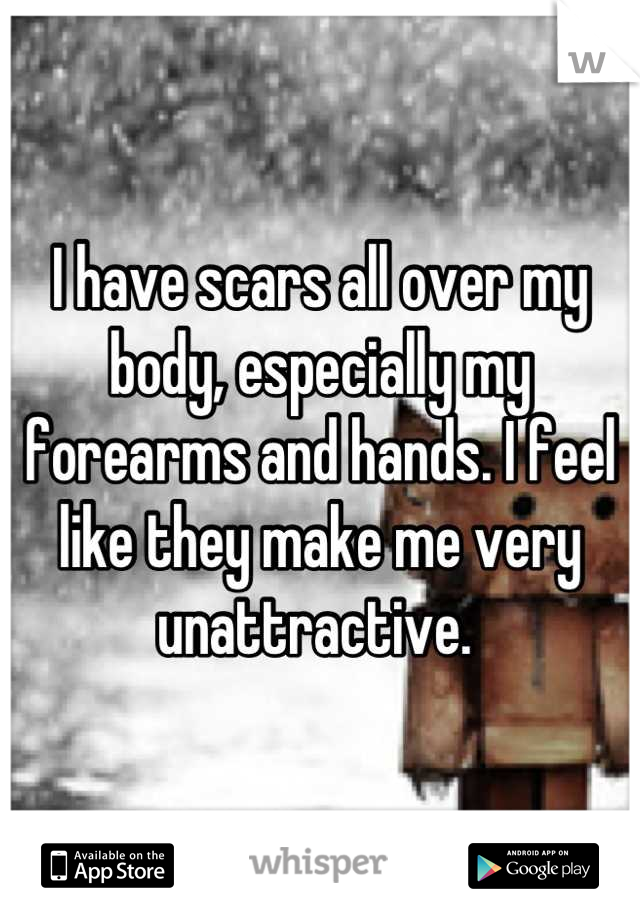 I have scars all over my body, especially my forearms and hands. I feel like they make me very unattractive. 