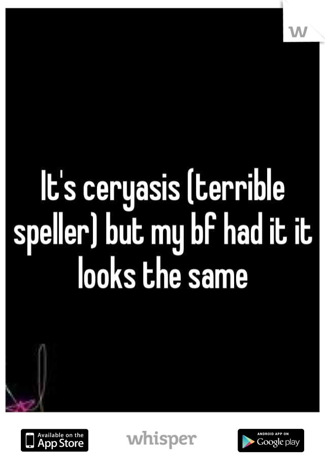 It's ceryasis (terrible speller) but my bf had it it looks the same