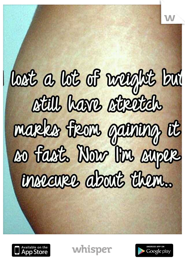 I lost a lot of weight but still have stretch marks from gaining it so fast. Now I'm super insecure about them..