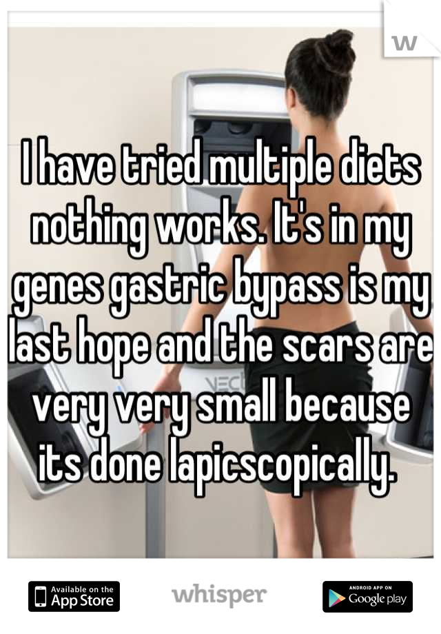 I have tried multiple diets nothing works. It's in my genes gastric bypass is my last hope and the scars are very very small because its done lapicscopically. 