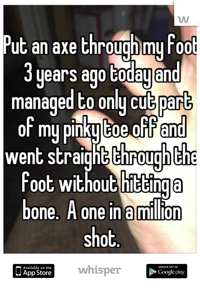 Put an axe through my foot 3 years ago today and managed to only cut part of my pinky toe off and went straight through the foot without hitting a bone.  A one in a million shot.