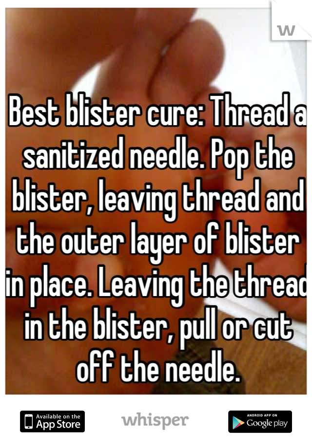 Best blister cure: Thread a sanitized needle. Pop the blister, leaving thread and the outer layer of blister in place. Leaving the thread in the blister, pull or cut off the needle.