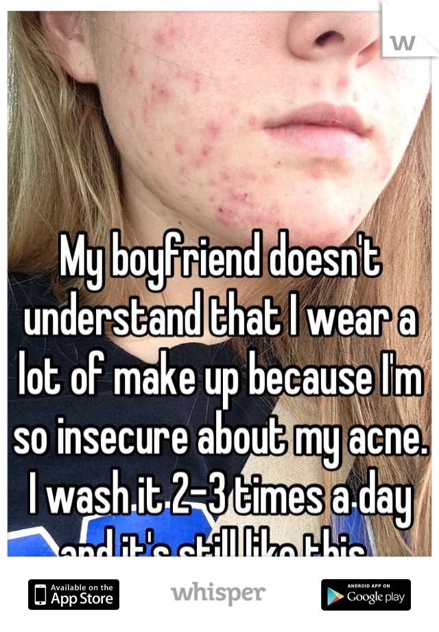 My boyfriend doesn't understand that I wear a lot of make up because I'm so insecure about my acne. I wash it 2-3 times a day and it's still like this. 