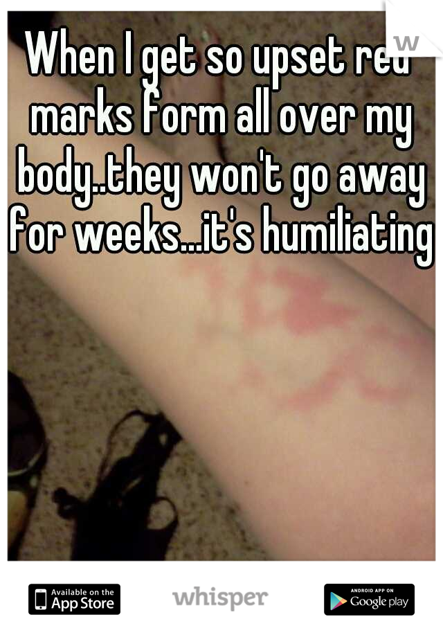 When I get so upset red marks form all over my body..they won't go away for weeks...it's humiliating 