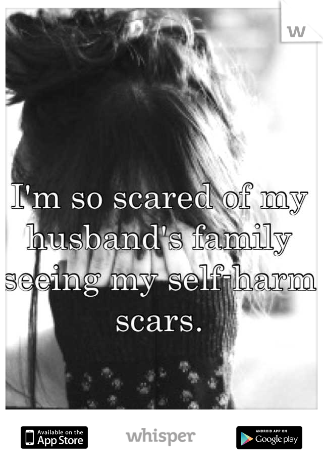 I'm so scared of my husband's family seeing my self-harm scars.