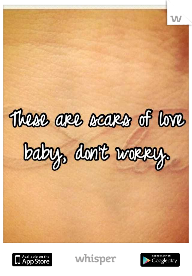 These are scars of love baby, don't worry.