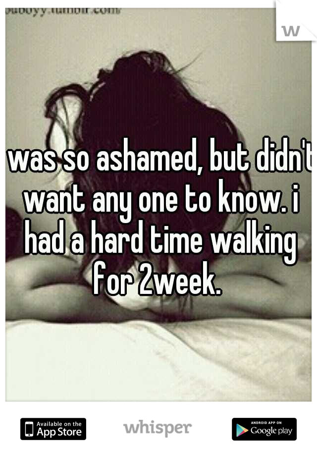 I was so ashamed, but didn't want any one to know. i had a hard time walking for 2week. 