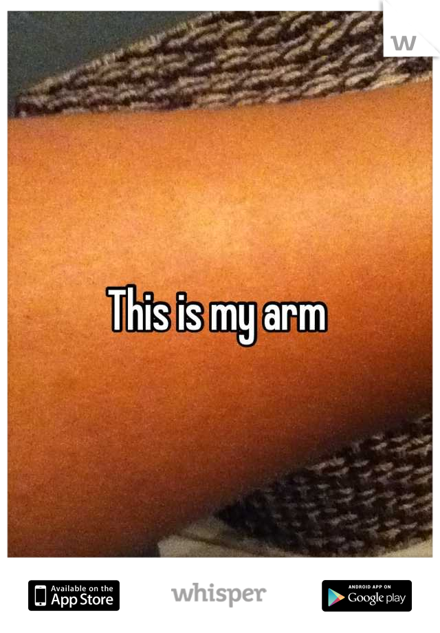 This is my arm 