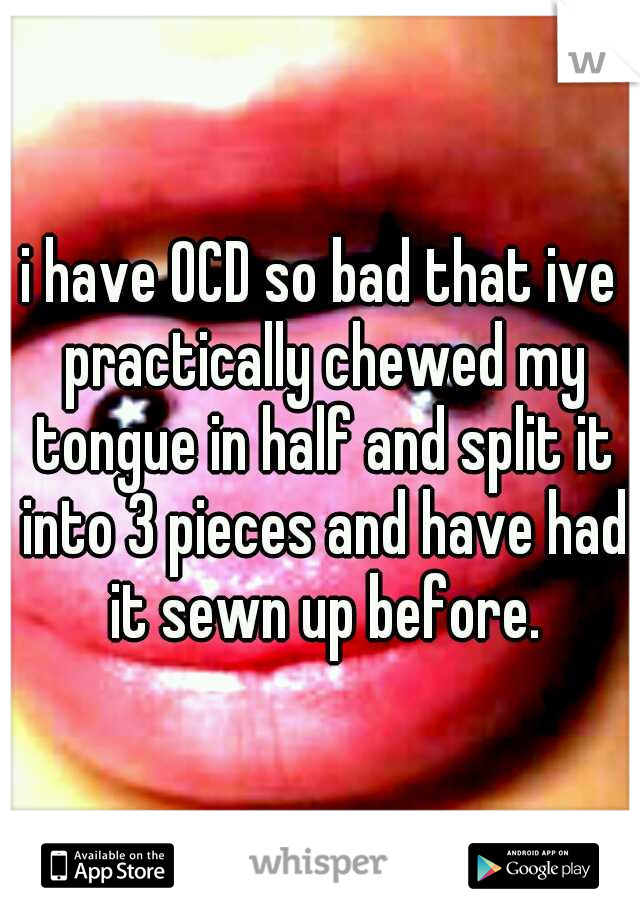 i have OCD so bad that ive practically chewed my tongue in half and split it into 3 pieces and have had it sewn up before.