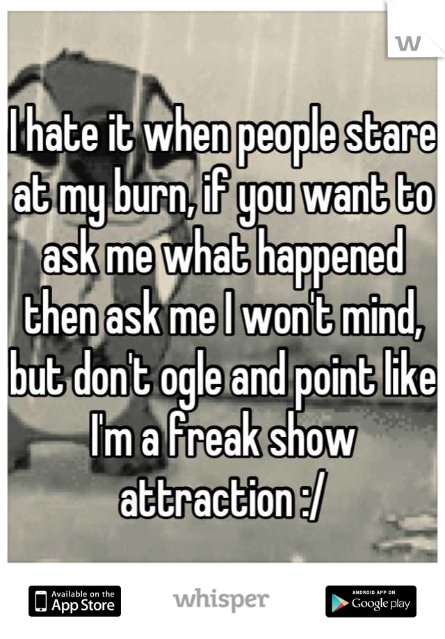 I hate it when people stare at my burn, if you want to ask me what happened then ask me I won't mind, but don't ogle and point like I'm a freak show attraction :/