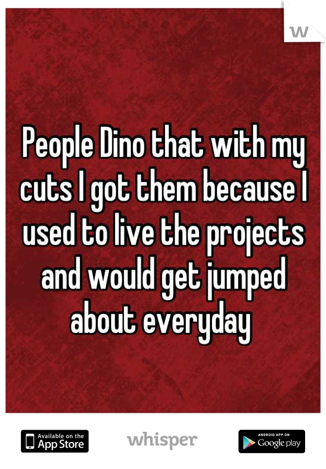 People Dino that with my cuts I got them because I used to live the projects and would get jumped about everyday 