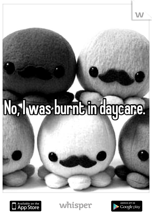 No, I was burnt in daycare. 