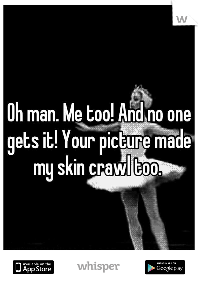 Oh man. Me too! And no one gets it! Your picture made my skin crawl too. 