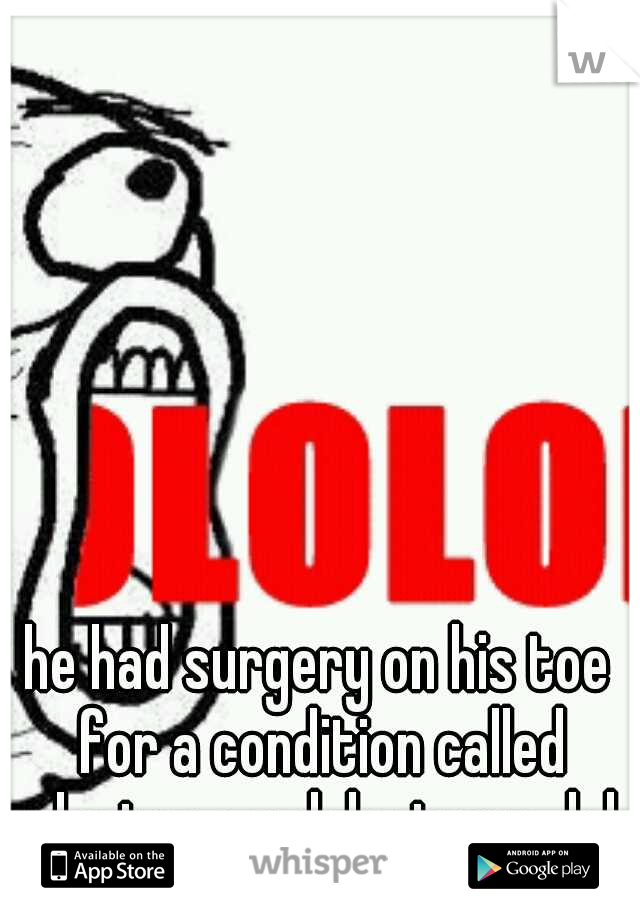 he had surgery on his toe for a condition called plantar condylectomy...lol
