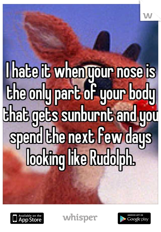 I hate it when your nose is the only part of your body that gets sunburnt and you spend the next few days looking like Rudolph.