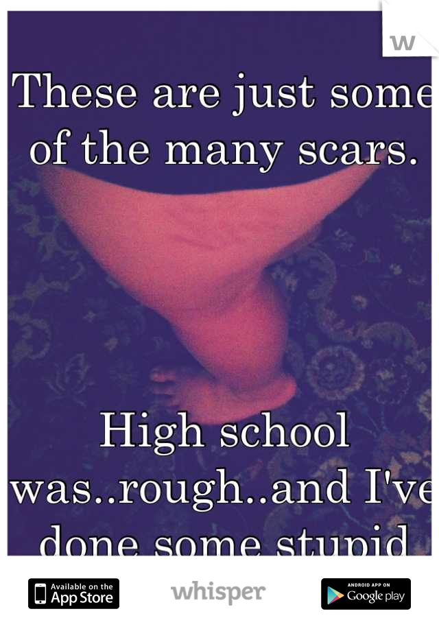 These are just some of the many scars. 




High school was..rough..and I've done some stupid shit.
