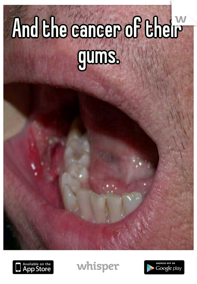 And the cancer of their gums.