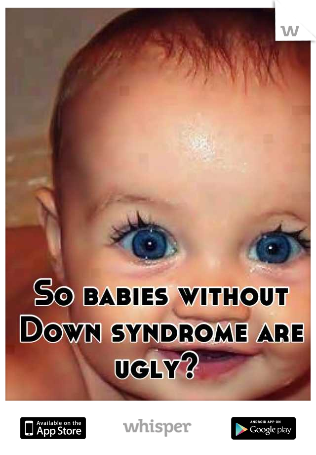 So babies without Down syndrome are ugly? 
