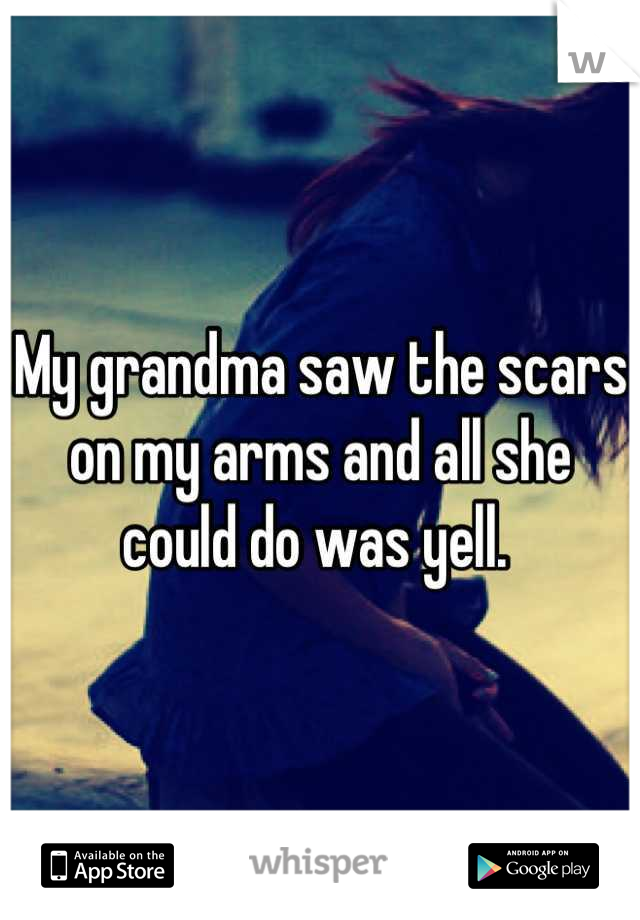 My grandma saw the scars on my arms and all she could do was yell. 