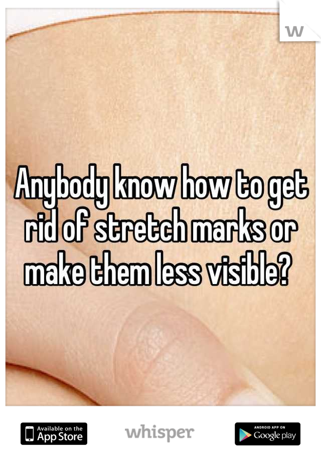 Anybody know how to get rid of stretch marks or make them less visible? 