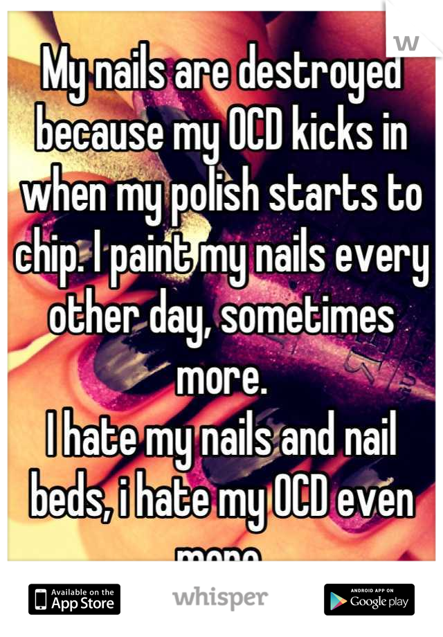 My nails are destroyed because my OCD kicks in when my polish starts to chip. I paint my nails every other day, sometimes more.
I hate my nails and nail beds, i hate my OCD even more.