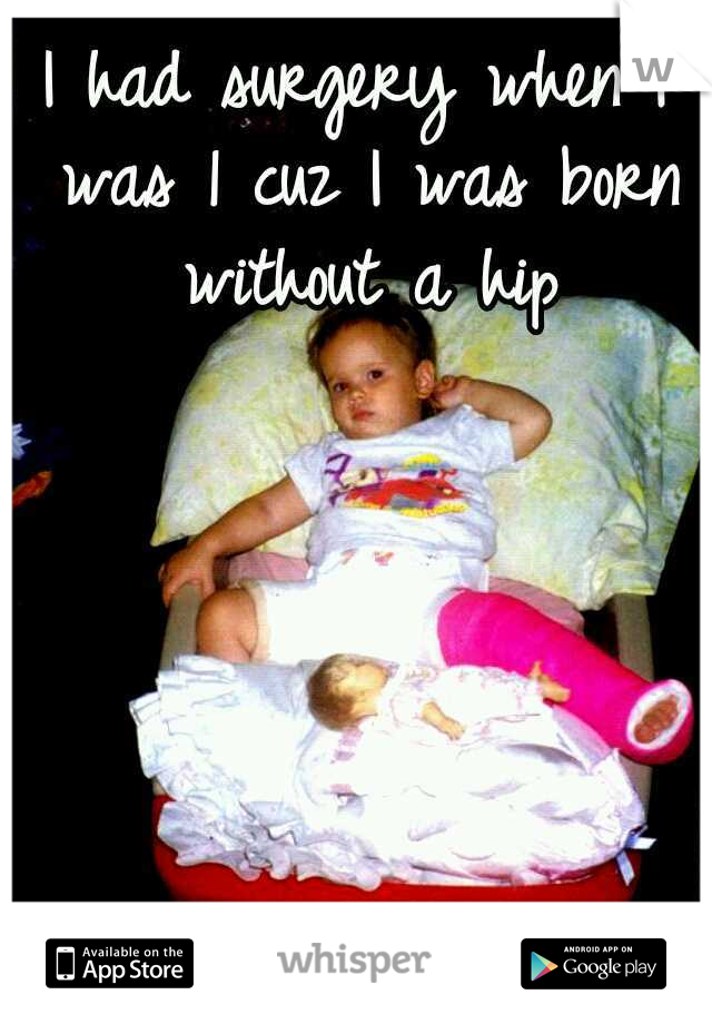 I had surgery when I was 1 cuz I was born without a hip