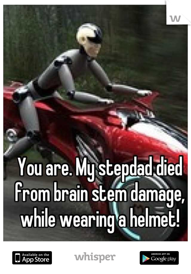 You are. My stepdad died from brain stem damage, while wearing a helmet!