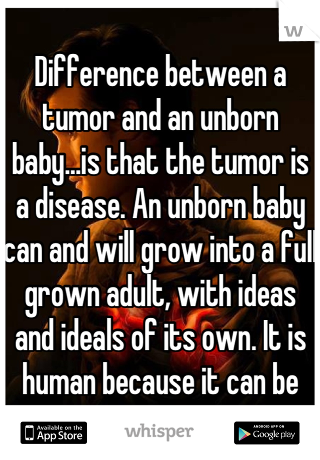 Difference between a tumor and an unborn baby...is that the tumor is a disease. An unborn baby can and will grow into a full grown adult, with ideas and ideals of its own. It is human because it can be