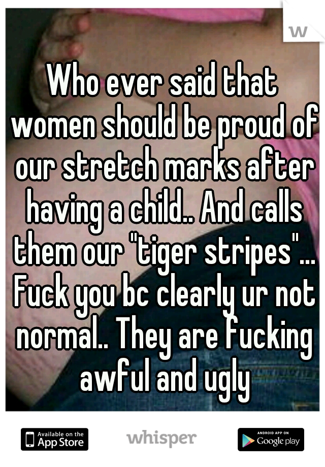 Who ever said that women should be proud of our stretch marks after having a child.. And calls them our "tiger stripes"... Fuck you bc clearly ur not normal.. They are fucking awful and ugly