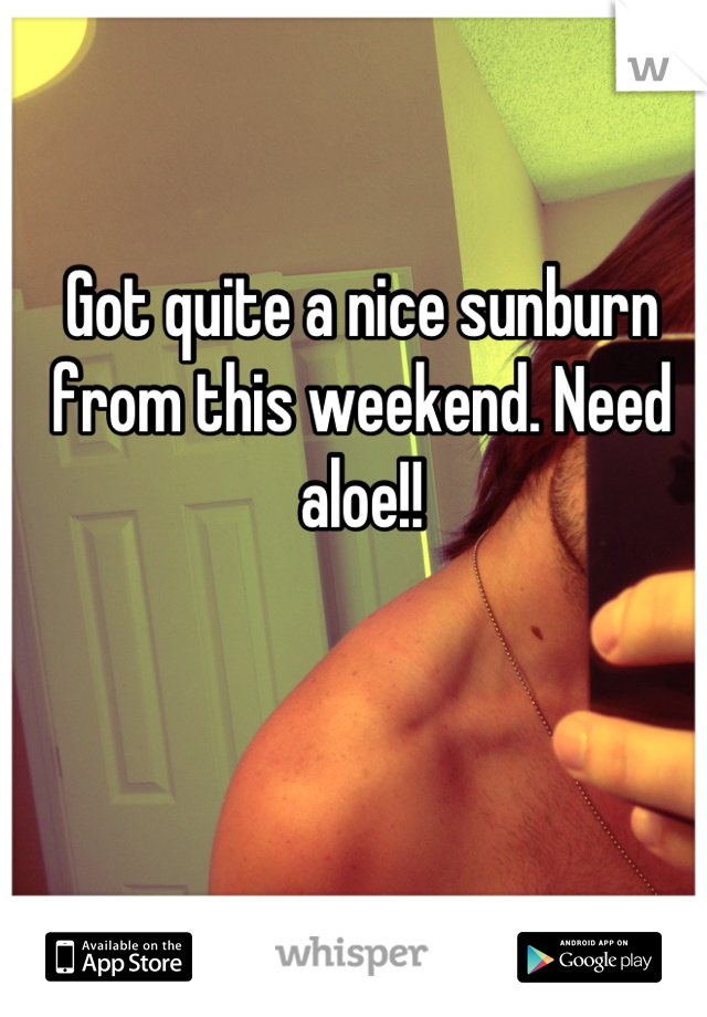 Got quite a nice sunburn from this weekend. Need aloe!!