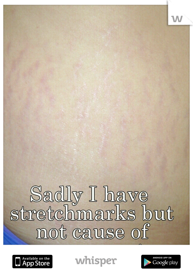 Sadly I have stretchmarks but not cause of pregnancy :c