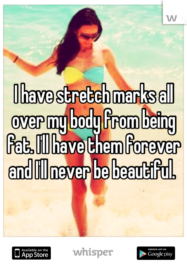 I have stretch marks all over my body from being fat. I'll have them forever and I'll never be beautiful. 