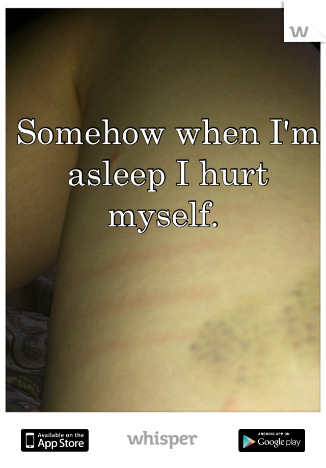 Somehow when I'm asleep I hurt myself. 
