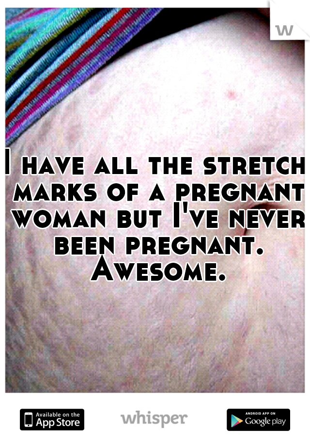 I have all the stretch marks of a pregnant woman but I've never been pregnant. Awesome.