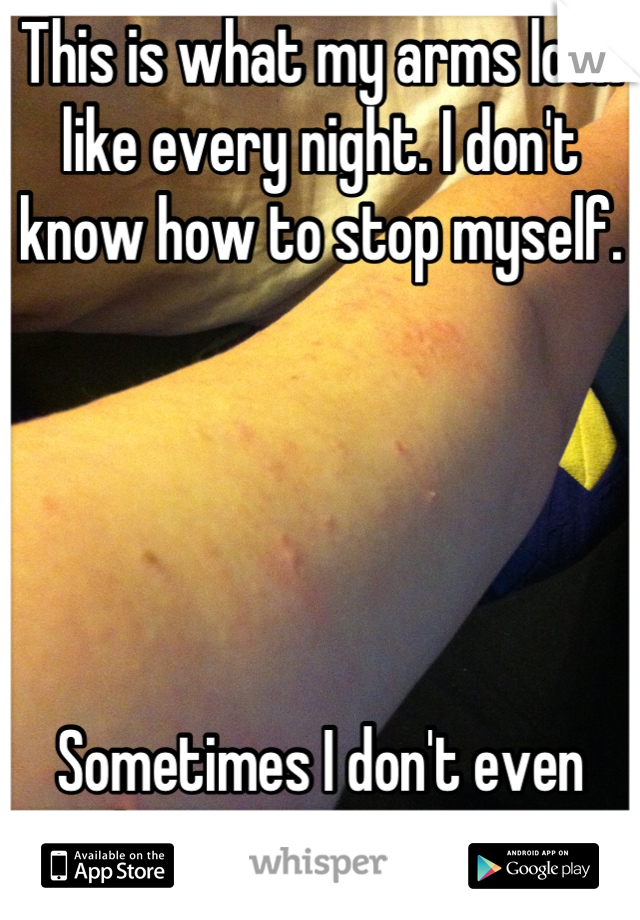 This is what my arms look like every night. I don't know how to stop myself. 





Sometimes I don't even know I'm doing it...