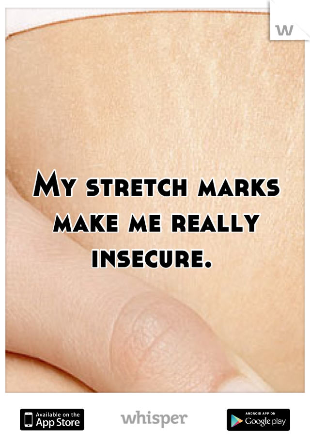 My stretch marks make me really insecure. 