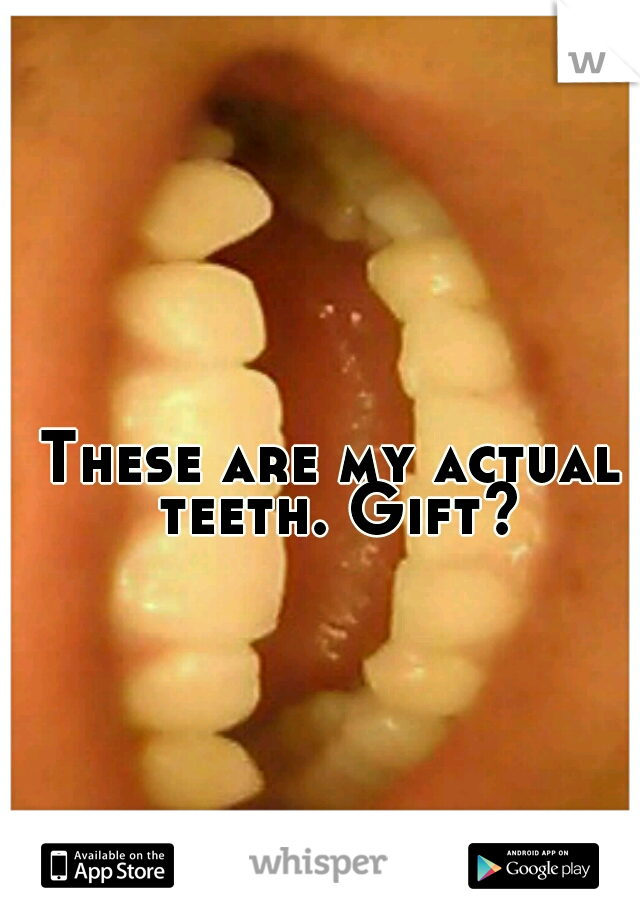 These are my actual teeth. Gift?