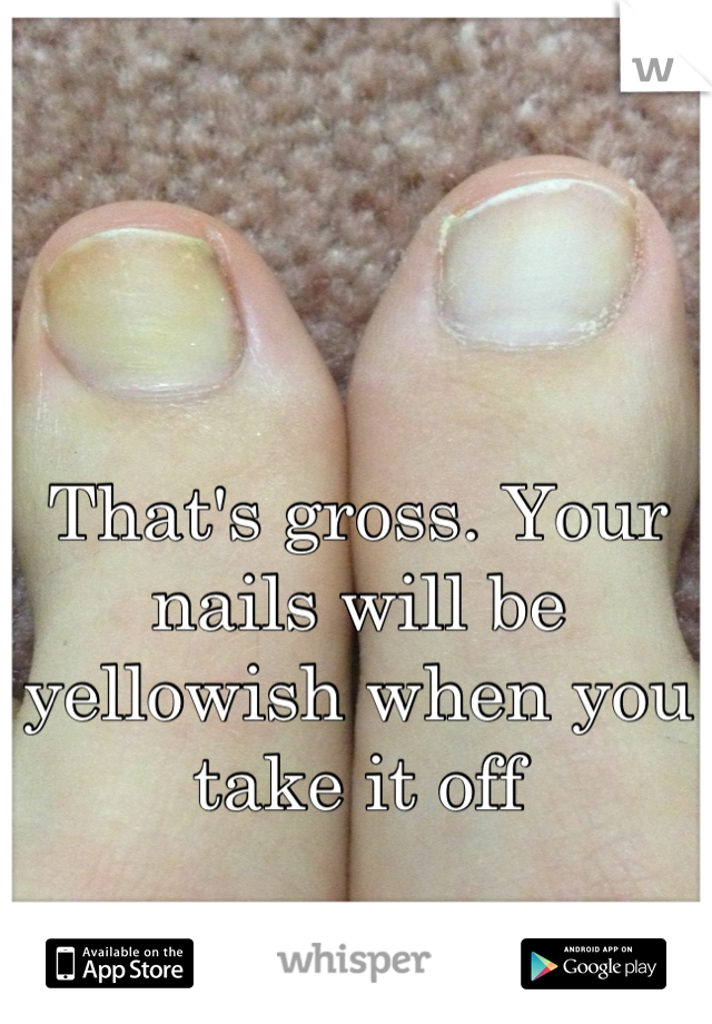That's gross. Your nails will be yellowish when you take it off